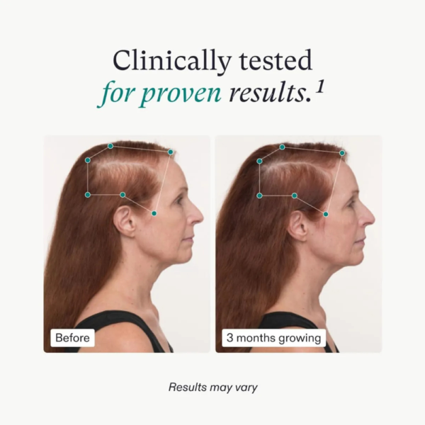 Nutrafol Men’s Hair Growth Supplements - Image 5